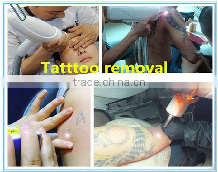 hot selling laser tattoo removal machine price
