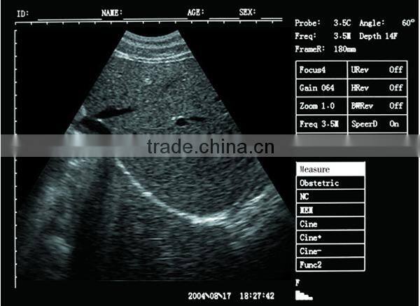 Sonostar good quality handheld portable vet ultrasound scanner pig veterinary ultrasound V6