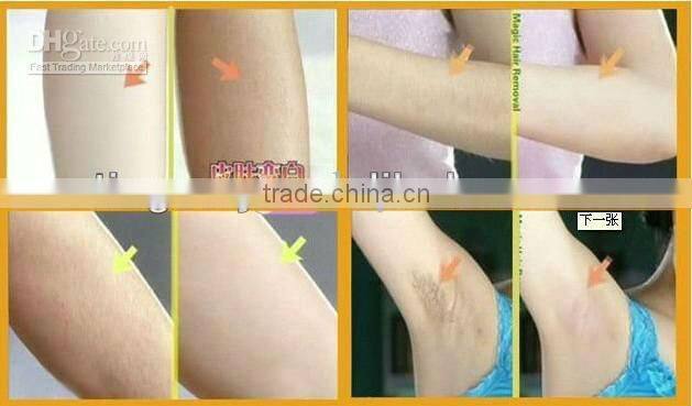 hair removal paraffin wax heater price tm-b5001