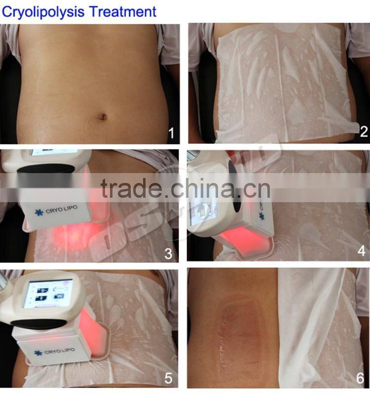 Cryotherapy Machine Cryolipolysis System Slimming Massage Machine