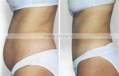 F019-ultrasonic portable 1mhz ultrasound lipolysis machines