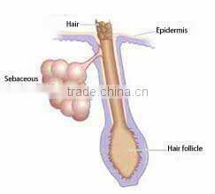 2015 vertical 808nm laser hair removal diode Machine Price For Sale