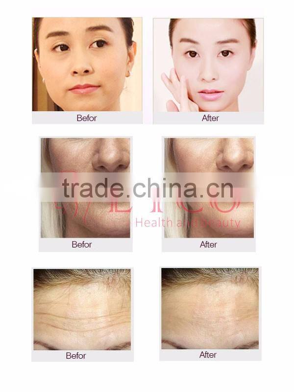 Hot sale!!portable salon beauty equipment bipolar radiofrequency skin tightening home use rf machine for skin care