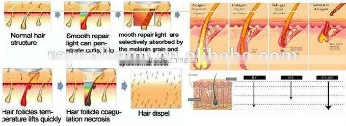 Pain-free Depilation Device hair removal SHR IPL