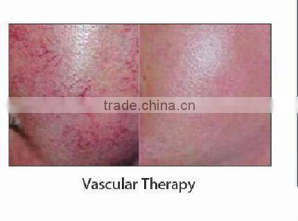 (New Price) E light hair reducing and skin care beauty equipment