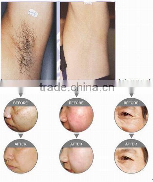 hot-sale 8 inch screen high power e-light beauty part ipl parts