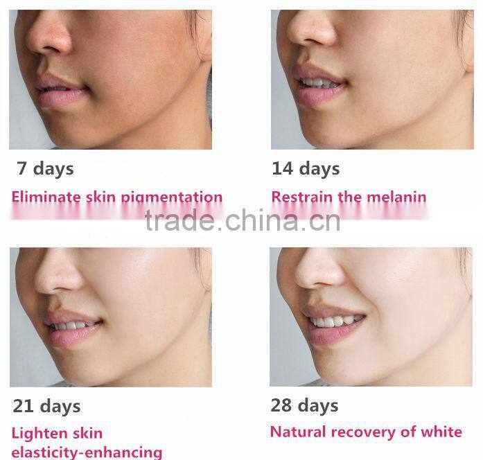 Quick effective beauty face whitening cream hydroquinone