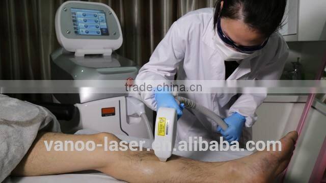 Promotion !!! 808nm diode laser in motion hair removal machine