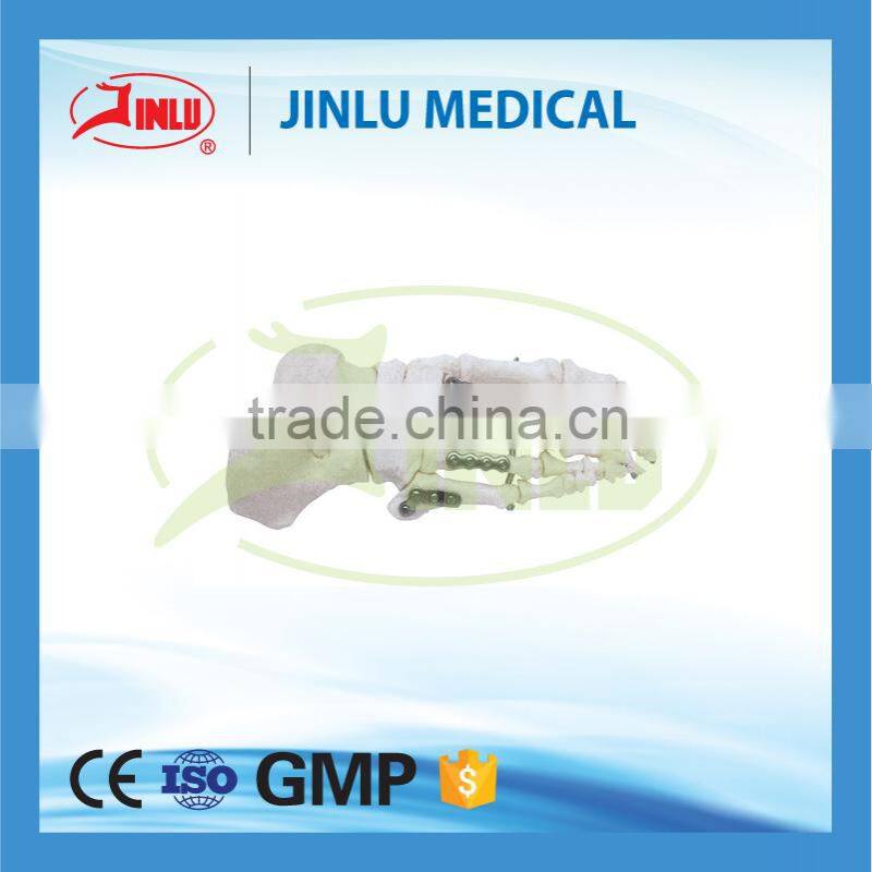 JINLU CE approved factory metacaral plate veterinary implants,veterinary plate animal plates,medical veterinary micro plate