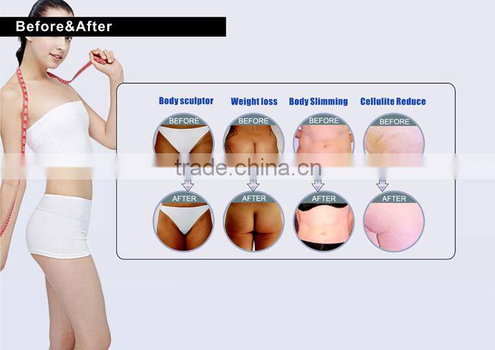 Hot sale Skin tighten and body slimming machine