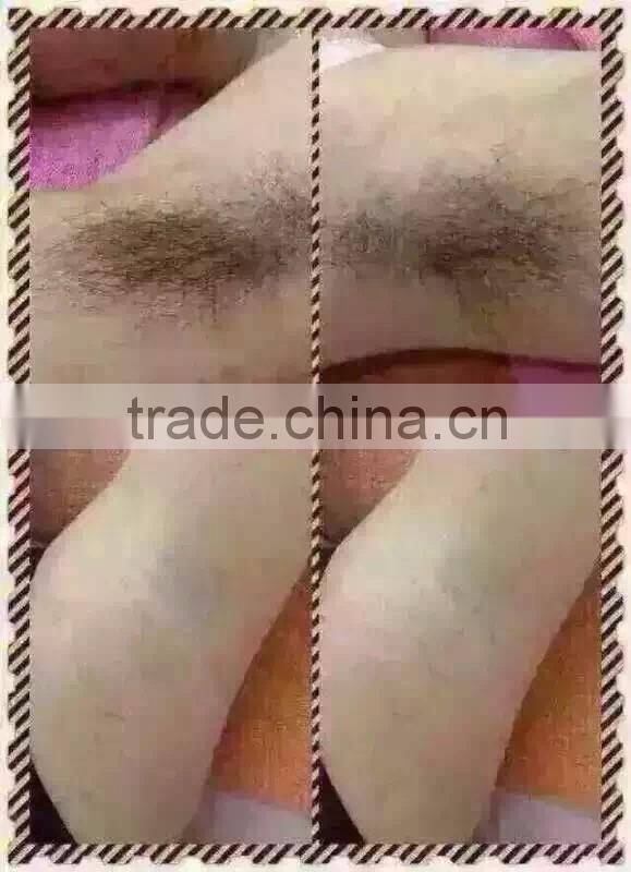 acne removal beauty device elight beauty ipl laser machine price