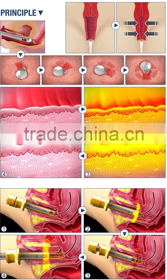 Lingmei medical scar removal co2 fractional aesthetic laser equipment