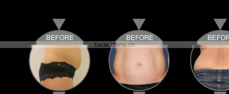 hot shaping machineultrasonic blackhead remover cellulite reduction liposonix