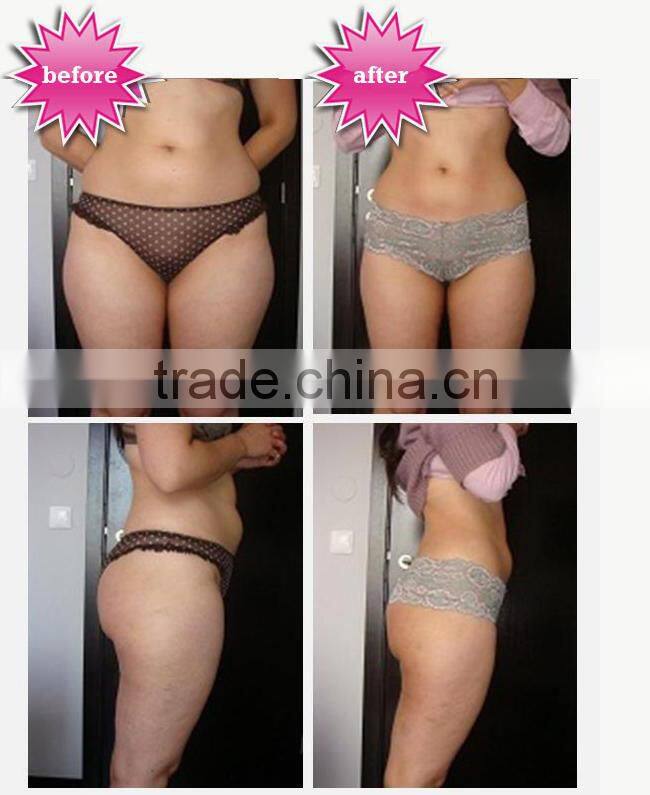 2013 Excellent Effective Exquisite!!!ultrasound slimming cavitation heater(HOT IN Europe!!!!!!!!!!)