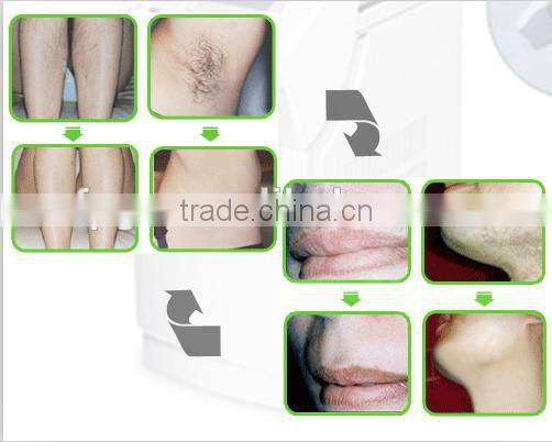 ipl (rf +yag) shr elight laser hair removal machine