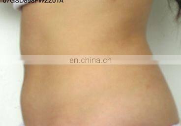 Professional GSD Vibration New Technology Roller Suction RF Face Laser Beauty Vacuum Cool HIFU Body Slimming Machine Omnislim