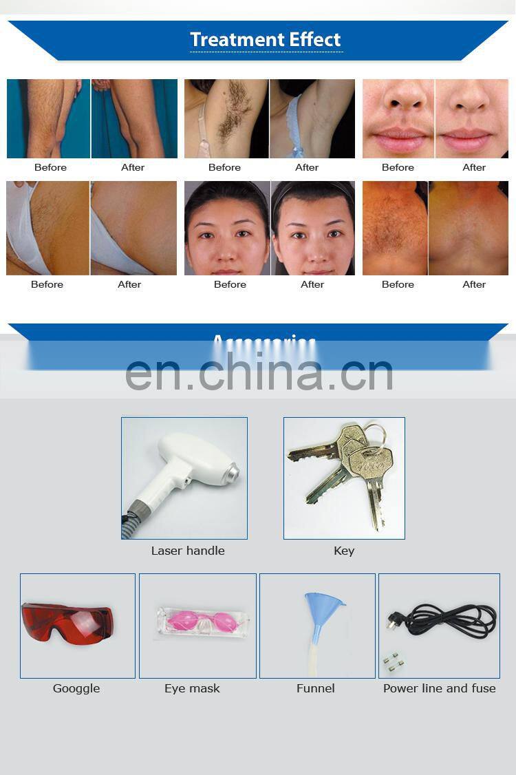 Professional 808nm diode definitive depilation laser hair removal