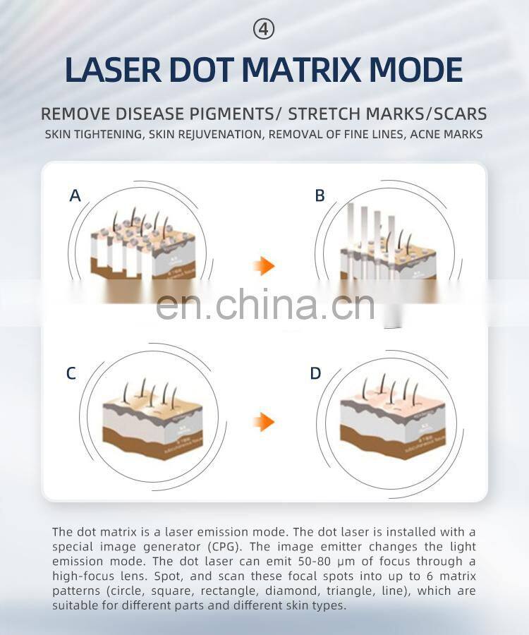 Medical CE TUV Industry Top 2022 Newest CO2 Fractional Laser/CO2 Surgical Laser/Vaginal co2 fractional laser machine