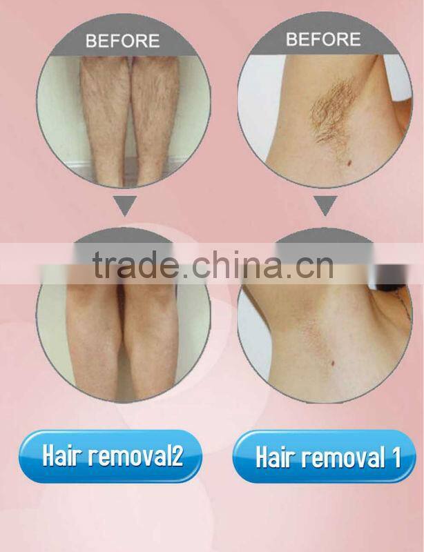Best selling products 808 diode laser machine for hair removal OB-DH 04