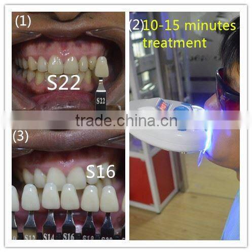 2015 10ml Non Peroxide Teeth Whitening Gel