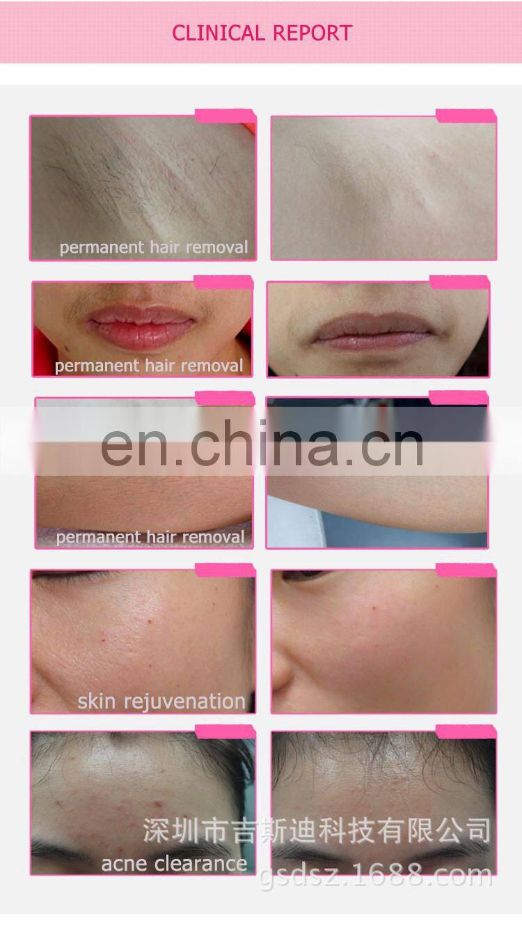 DEESS IPL GP582 multi-function beauty machine home use facial machine for permanent hair removal