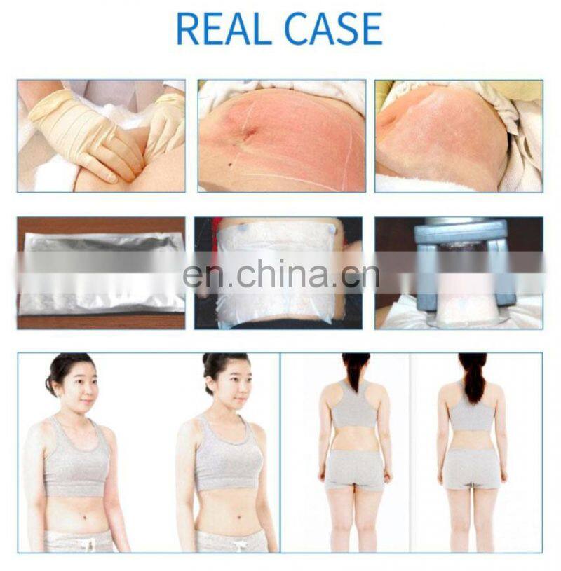 Sales multipolar radio frequency multi function cavitation for weight loss beauty machine vacuum rf cavitation