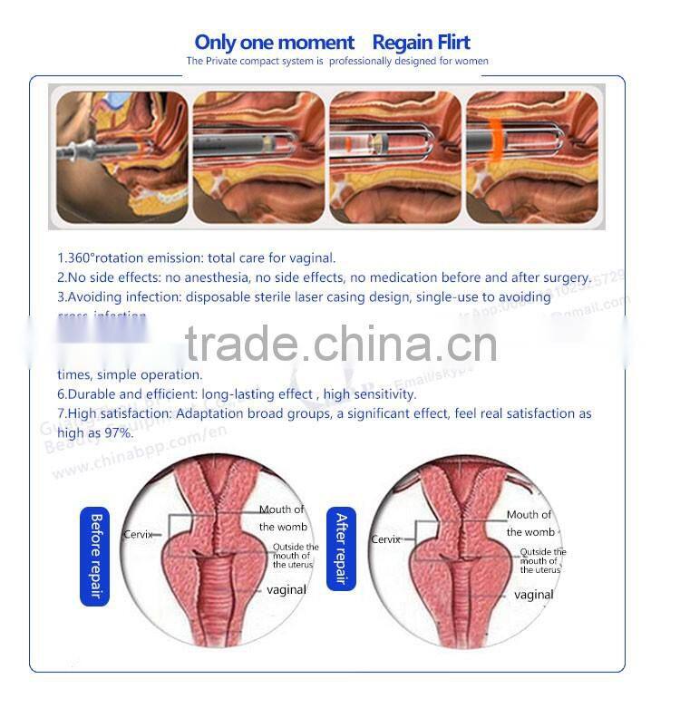 2016 Fractional Co2 Laser / vagina cleaning machine / Laser Co2 Fractional Vaginal