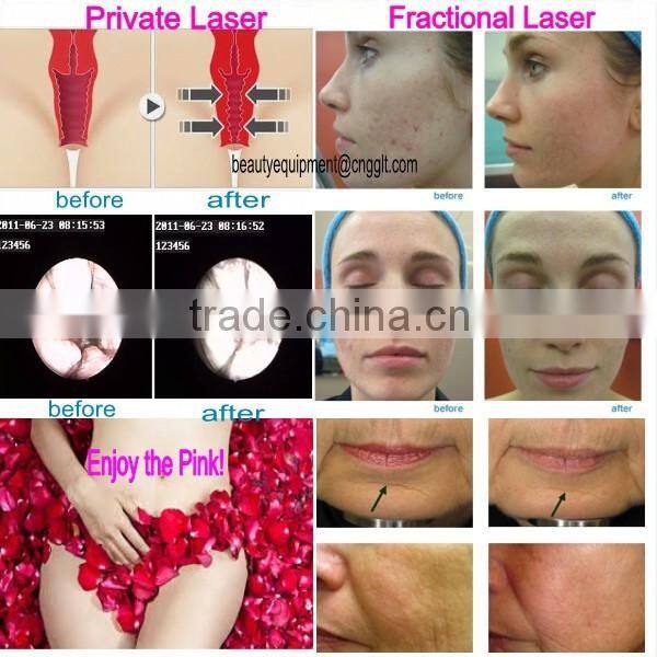 women care for vaginafor hospital spa and clinic