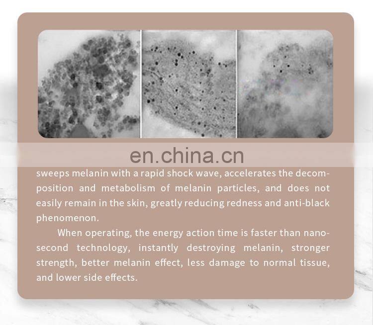 Vertical picosecond laser pico laser for pigmentation removal