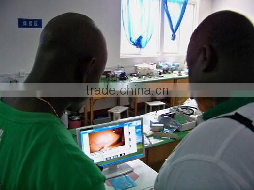 advanced digital electronic colposcope with new design