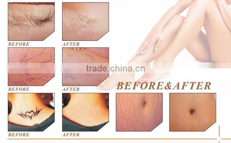 High Quality Combined Multifunctional Machine Elight IPL RF