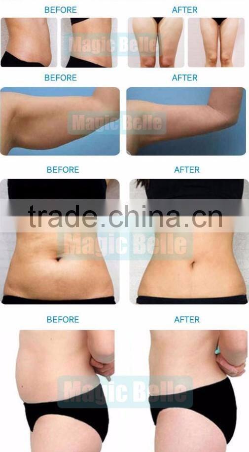 New product in 2016 40k cavitation slimming beauty machine ultrasonic cavitation in china
