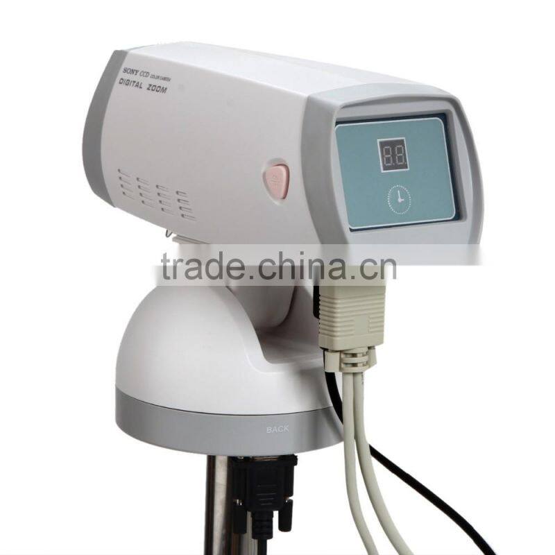 Medical Equipment Portable Digital Camera Vaginoscope Colposcope