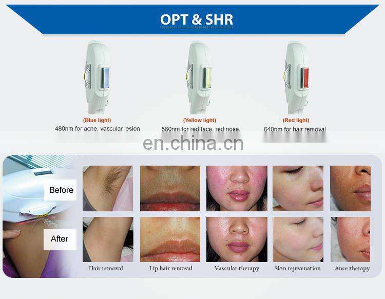 Multifunctional Beauty Equipment Cold System RF Skin Tightening IPL E-light SHR Hair Removal Laser Tattoo Removal Machine