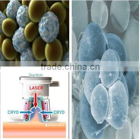 2016 hot product fat freeze criolipolisis professional/handle for criolipolisis