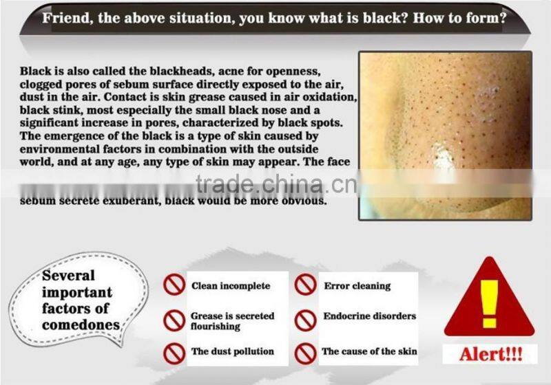 HOT WHOLESALE 60g Pilaten black mud facial mask Blackhead Remover Mask Acne Remover