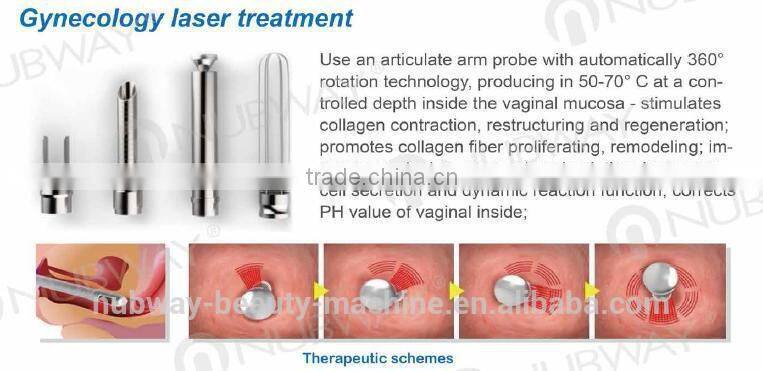30000 Hours Long Life Time American RF Tube CO2 Fractional Laser