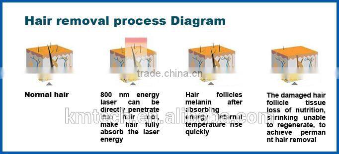 808 nm Diode Laser Comfortable, Painless Freezing Point Hair Removing Beauty Equipment