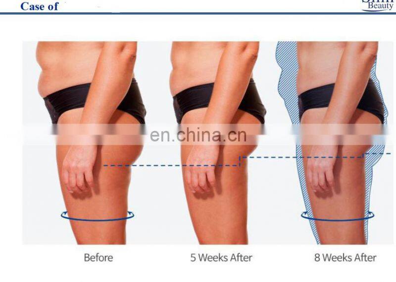 Muscle Stimulator Body Building EMS RF Machine with 4 Handles