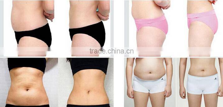 distributor wanted!!Sanhe New Products hifu machine 33mm-63mm fat reduce hifushape hifu slimming fat reduce machine