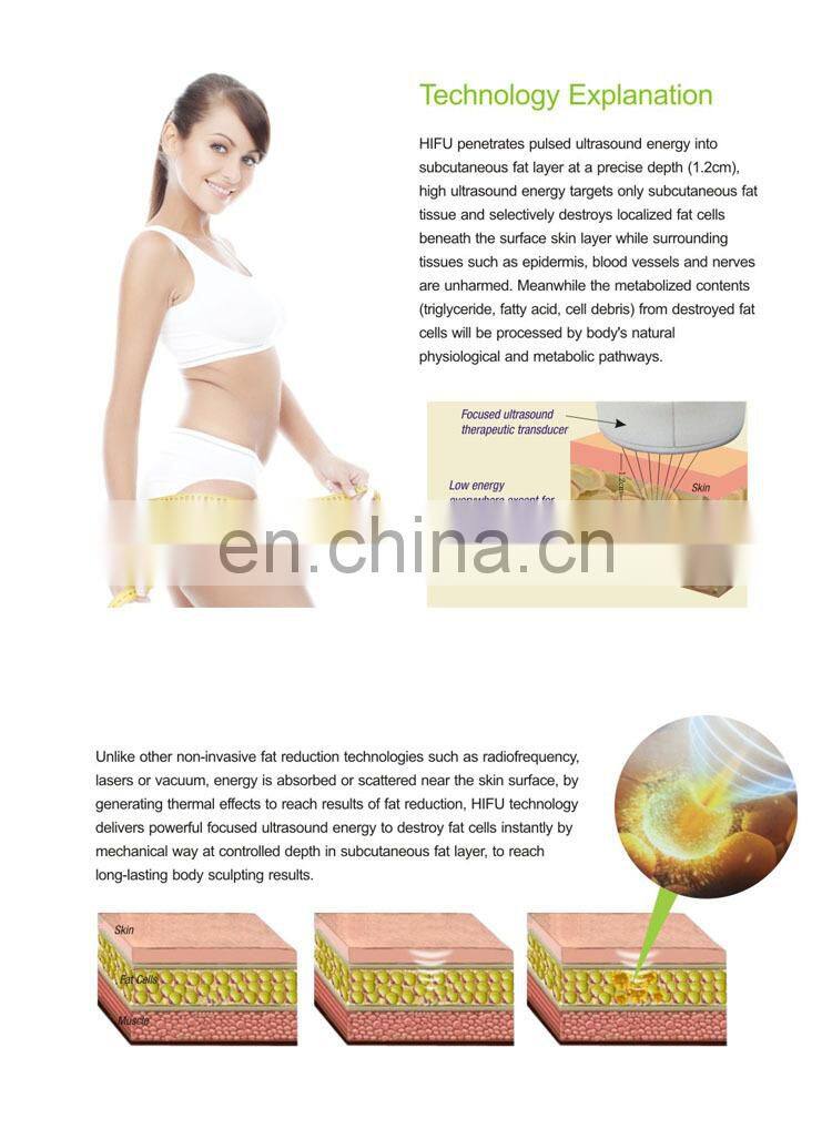 Latest Technology SMAS home HIFU for wrinkle removal system home hifu ultrasound medical treatment