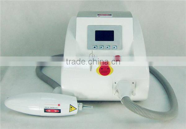 pigment removal yag laser tattoo removal laser 1064 532