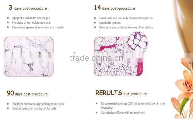 High Quality 2 In 1 Cryo Lipolysis Device Cryolipoly+ Lipolaser Slimming Machine