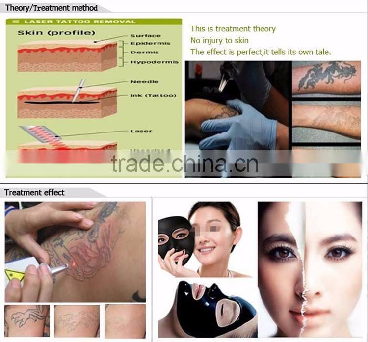 1064 nm / 532nm pigments removal q switch laser tatoo remove machine
