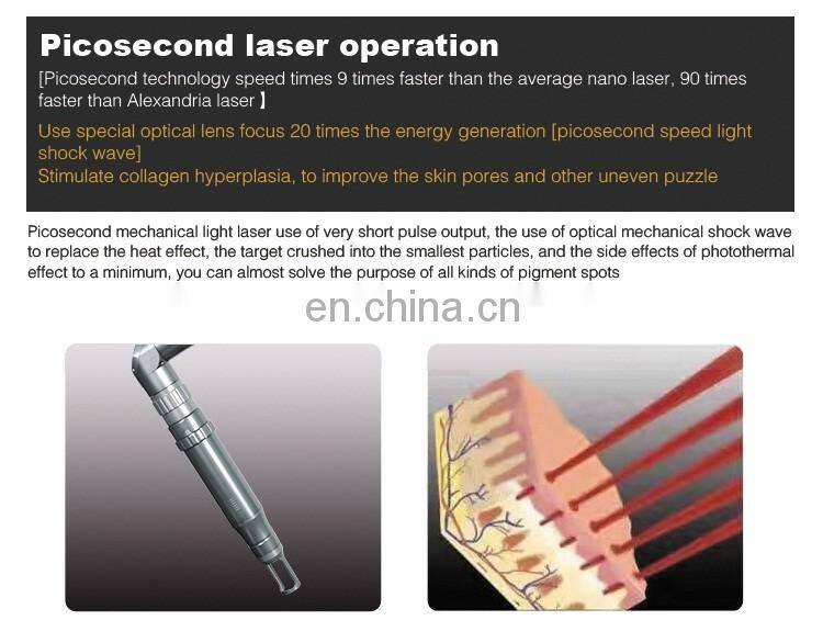 Picosecond remove tattoo Q switch machine for laser tattoo washing