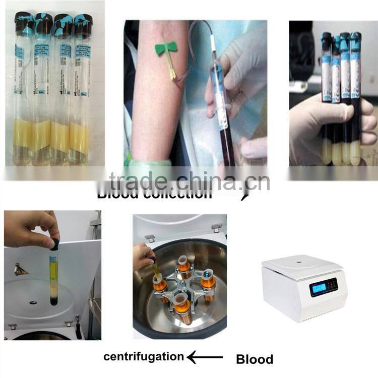 advance sealed caps syinges fat and blood plasma extract centrifuge TD4-MR