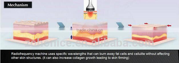 BD06C super RF vacuum with cryo Fat freezing sliming machine