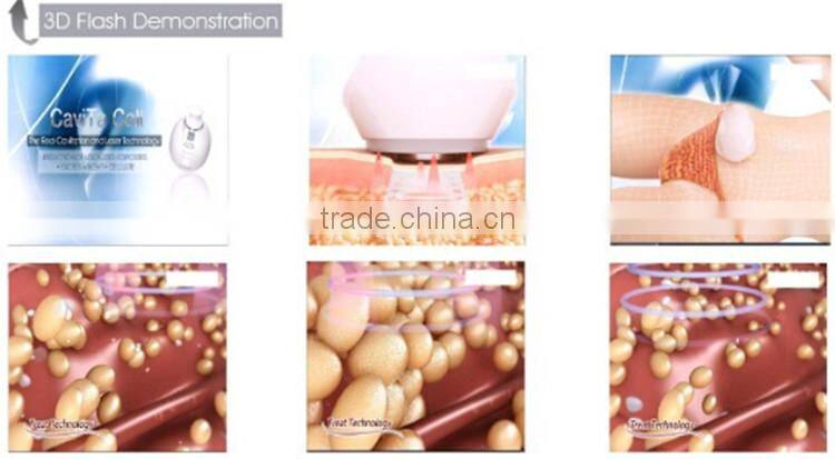 Hot sale portable home 32khz cavitation machine for weight loss with photon