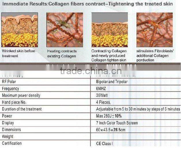 RF Wrinkle Smoothing skin rejuvenation skin firming With CE