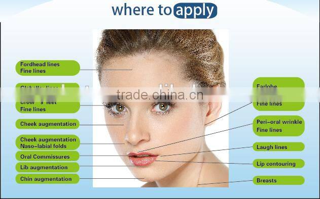 Safe and effective Cross Linked Hyaluronic acid gel injection